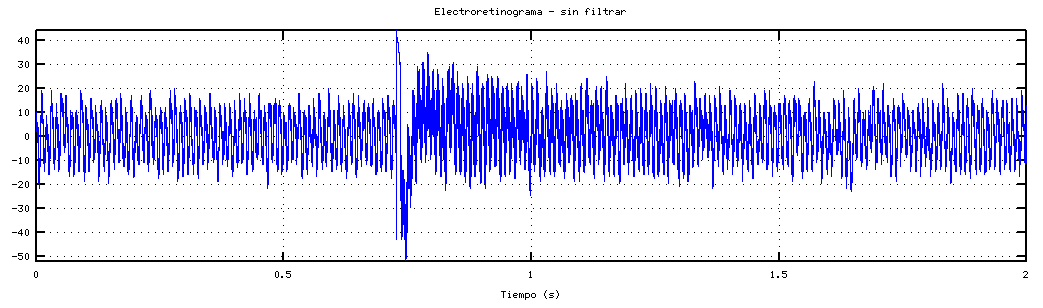 electrocardiograma