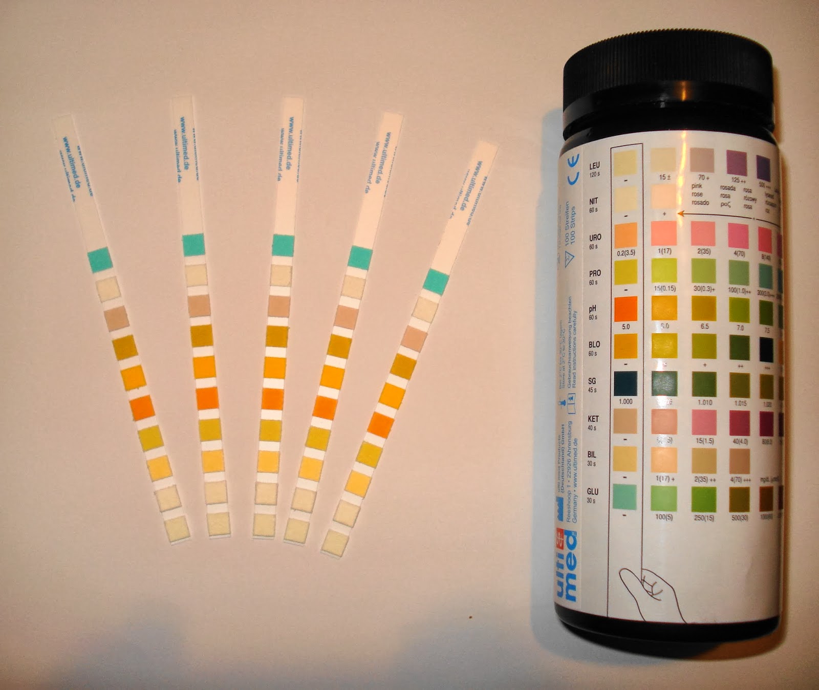 urine general test